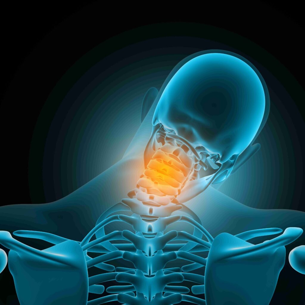 Cervical Spondylosis Management in Kondapur